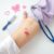 Choroby dziecięce z wysypką: objawy, diagnostyka i leczenie