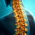 Leczenie chorób kręgosłupa: nowoczesne metody i diagnostyka